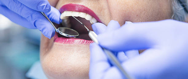 Best Broken or Chipped Tooth Repair in Greenacres, FL
